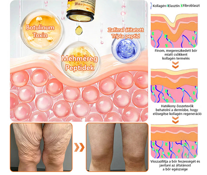 🧑⚕️Bőrgyógyász ajánlása 🐝 ZödVita® Méhmérges Regeneráló Krém 🔥 Ráncok, pigmentfoltok és megereszkedett bőr ellen – 50 ml🔥🔥