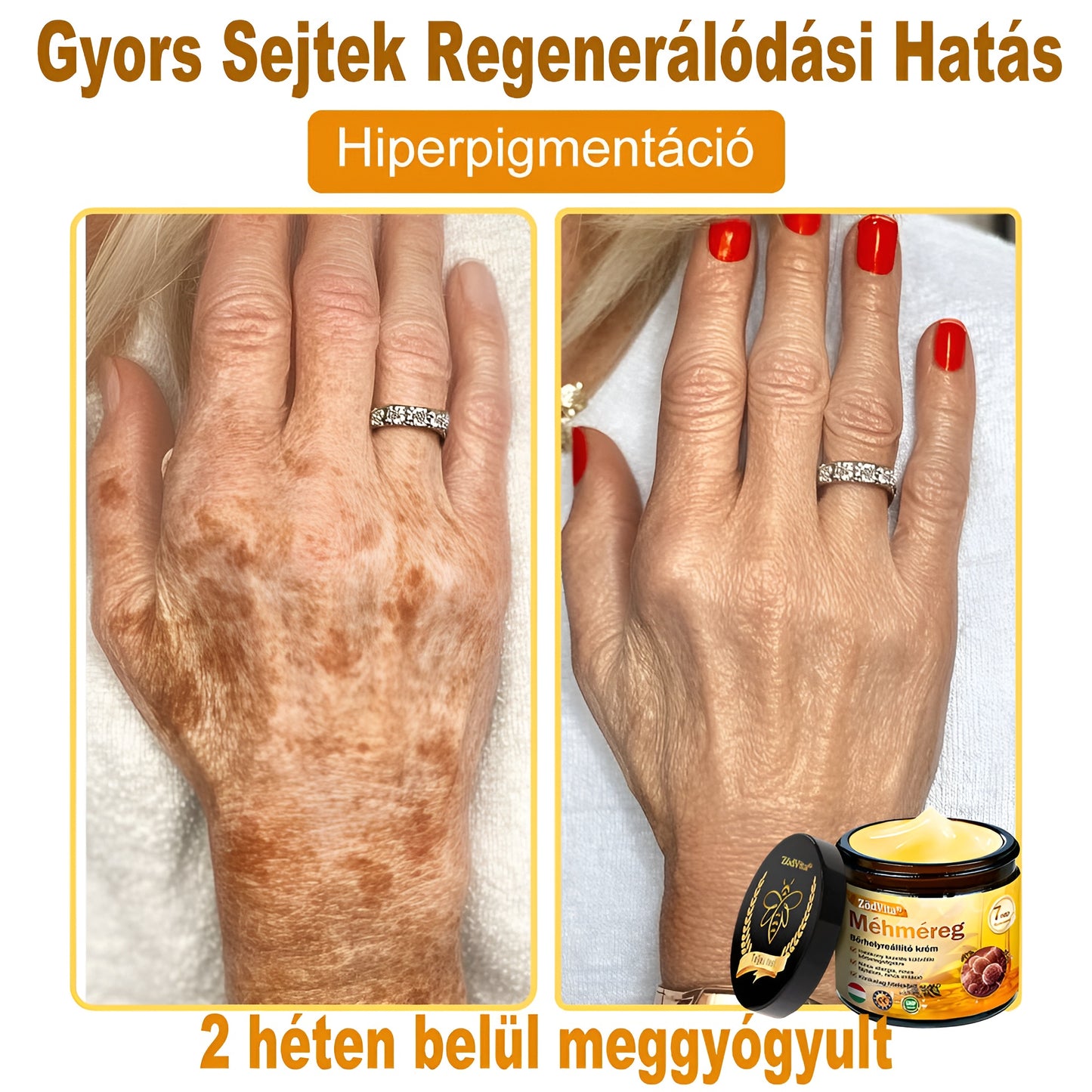 ✨ Bőrgyógyász ajánlása ✨ ZödVita® Méhméreg Bőr Helyreállító Krém 🔥 Magyar fejlesztés, magyarországi gyártás és szállítás