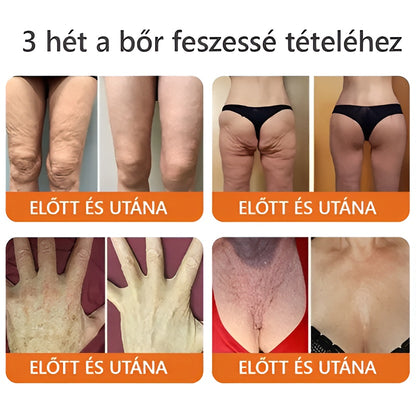 ZödVita® Méhméreg Bőr Helyreállító Krém 🔥 Magyar fejlesztés, magyarországi gyártás és szállítás🔥🔥