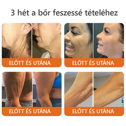 ZödVita® Méhméreg Bőr Helyreállító Krém 🔥 Magyar fejlesztés, magyarországi gyártás és szállítás🔥🔥