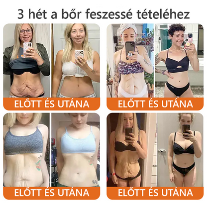 ZödVita® Méhméreg Bőr Helyreállító Krém 🔥 Magyar fejlesztés, magyarországi gyártás és szállítás🔥🔥