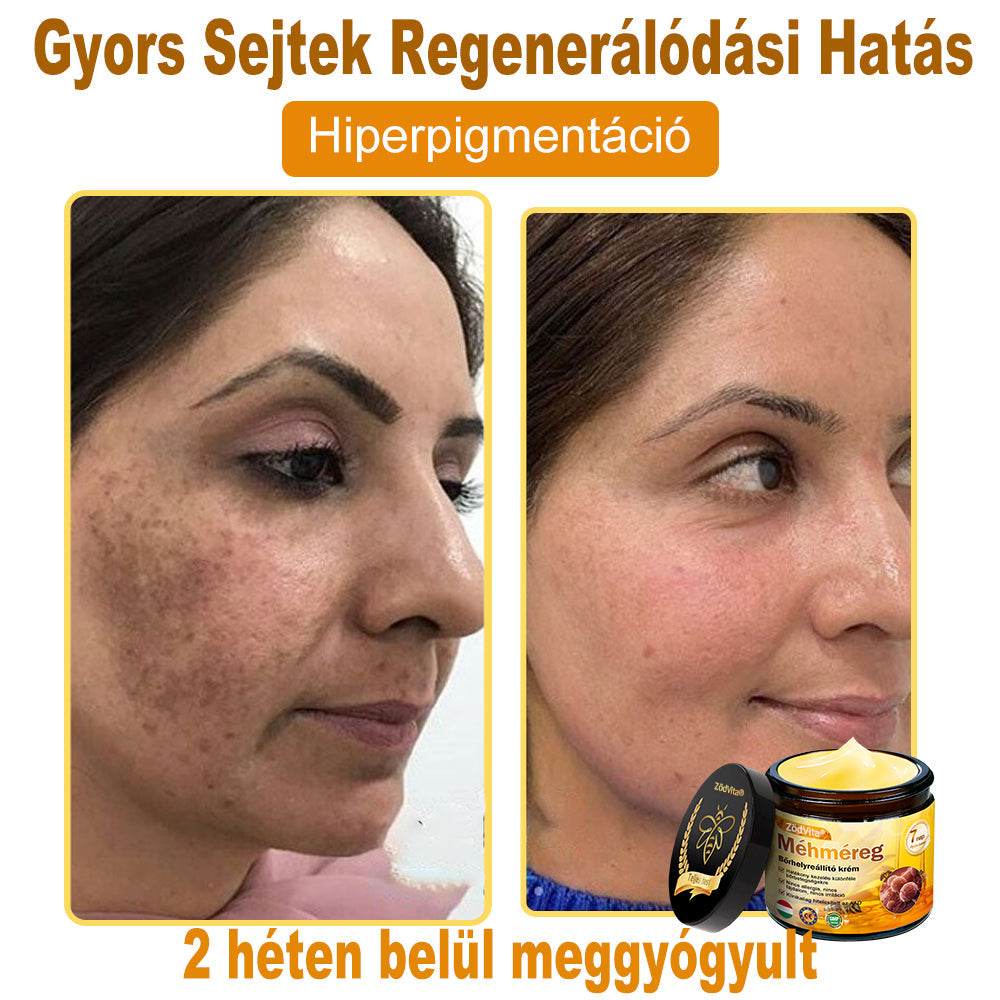 ZödVita® Méhméreg Bőr Helyreállító Krém 🔥 Magyar fejlesztés, magyarországi gyártás és szállítás🔥🔥