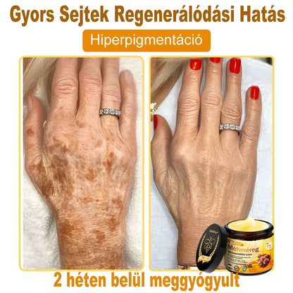 🧑‍⚕️Bőrgyógyász ajánlása 🐝 ZödVita® Méhmérges Regeneráló Krém 🔥 Ráncok, pigmentfoltok és megereszkedett bőr ellen – 50 ml🔥